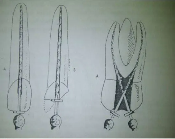 Gambar 2.5 A. Letak stop instrumen pada titik referensi insicivus dan molar. B. Fraktur insisal harus  diratakan  untuk  mendapatkan  titik  referensi