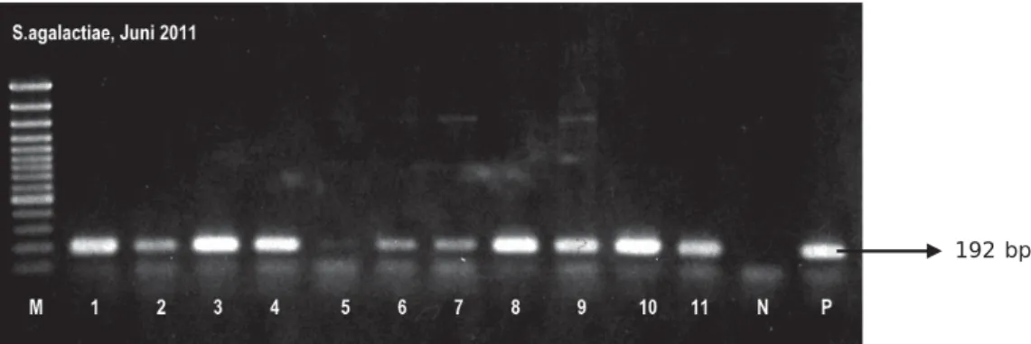 Gambar 3. Hasil deteksi PCR S. agalactiae dari jaringan ikan nila dengan mini-column QIAamp DNA mini kit 