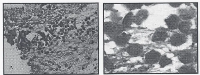 Gambar 2. Tampak sediaan mengandung blastospora dengan latar belakang eritrosit padat (pembesaran lemah (A)  dan pembesaran kuat (B).