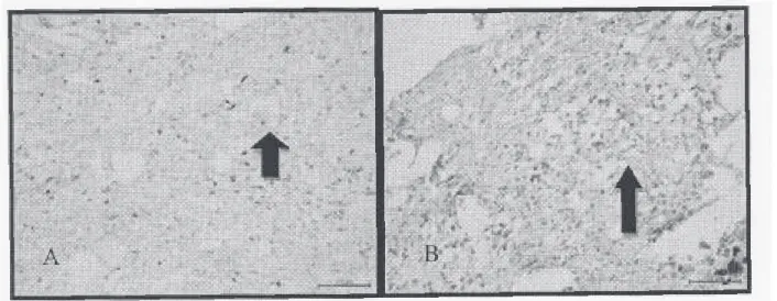 Gambar 4.  Hasil pemeriksaan histokimia dengan pewarnaan grocott methenamic silver (gambar A) dan periodic acid schiff (gambar B)