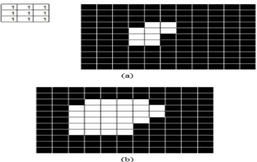 Gambar 2.3 (a) penataan element dan gambar sebelum operasi; (b) hasil 