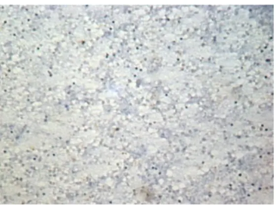 Gambar 4. Tampilan positif dengan pewarnaan immu- immu-nositokimia  ab905  yang  dengan  pewarnaan  MGG  tampak sebagai dark specks 