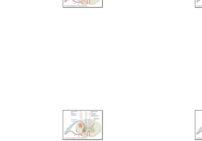 Gambar 4 : Sinaps traktus motorik descenden ke neuron kornu anterius (dikutip dari kepustakaan 4 )