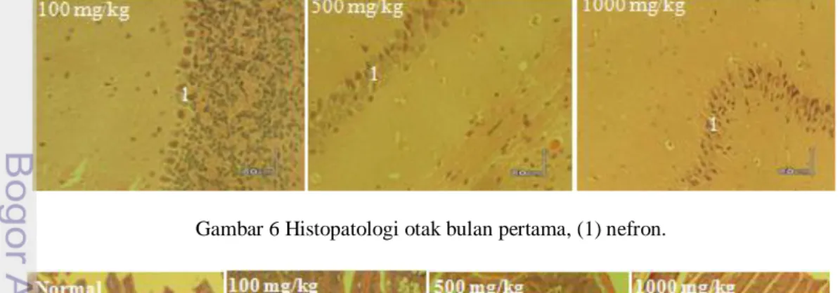 Gambar 7 Histopatologi usus bulan pertama, (1) sel goblet, (2) vili mukosa  Tabel 6 Hasil pengamatan histopatologi 