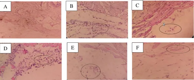 Gambar 1. Pengamatan mikroskopik sel neutrofil tiap kelompok. A) Kulit normal, B) Kulit  kontrol negatif, C) Kulit kontrol positif, D) Kulit kelompok uji ekstrak 0,5%, E) Kulit kelompok 