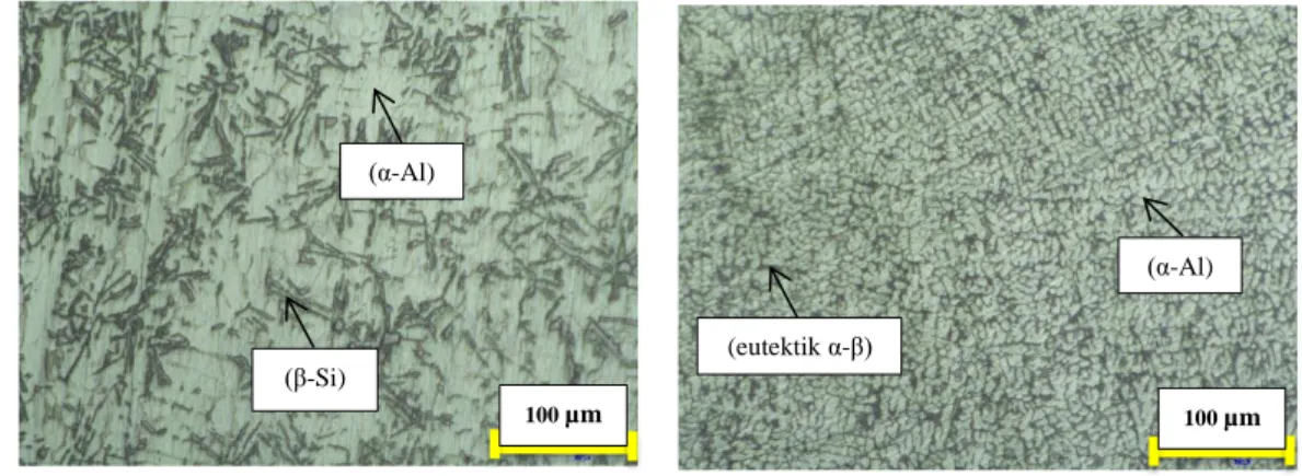 Gambar 4 Pengamatan Struktur Mikro pada pembesaran 100x (a) Metode  Sand Casting, (b) Metode Centrifugal Casting 