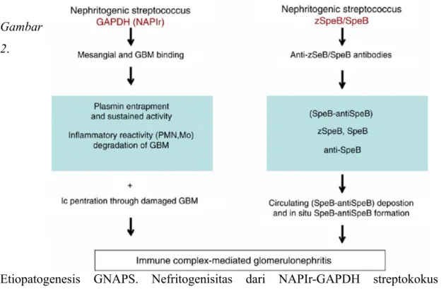 Gambar 1. Patofisiologi GNAPS, terjadi penumpukan kompleks imun di subepitel glomerulus