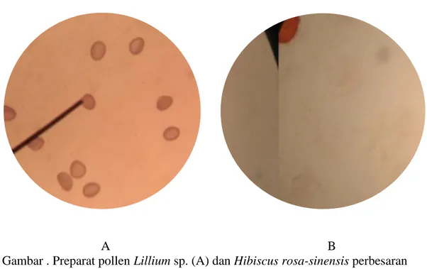 Gambar . Preparat pollen Lillium sp. (A) dan Hibiscus rosa-sinensis perbesaran    400 x 