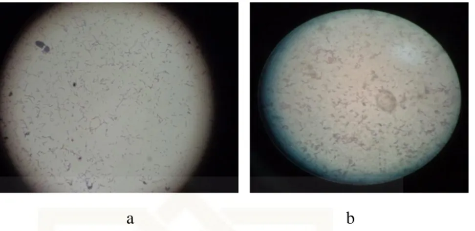 Gambar  4.  Sel  isolat  bakteri  Xh.C  di  dalam  media  adaptasi  yang  di  buktikan  dengan metode cat  gram pada (a) perbesaran 40 x 10;  (b) perbesaran  100 x10 