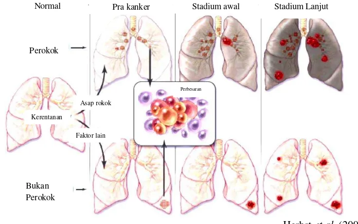 Gambar 1 Fase pertumbuhan kanker pada pasien perokok dan non-perokok 