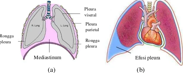 Gambar 2 Anatomi pleura paru. (a) pleura normal; (b) efusi pleura 