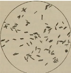 Gambar 2.3. Gambaran Mikroskopis Hasil Positif Tes Teichman b. Test Takayama (Tes kristal B Hemokromogen) 4