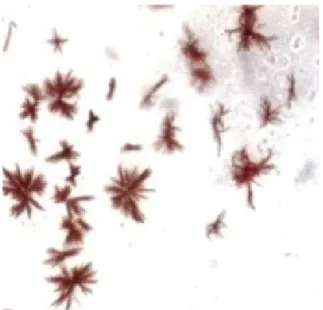 Gambar 2.4. Gambaran Mikroskopis Hasil Positif Tes Takayama