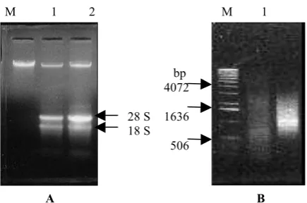 Gambar 2.  (A) RNA total  dari daun karet klon AVROS 2037,  dipisahkan   pada  0,8%  gel  agarose