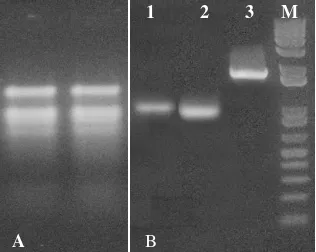 Gambar 2. (A) Profil elektroforesis RNA total hasil isolasi dari daun tebu. (B) Hasil          amplifikasi fragmen gen P5CS dengan beberapa primer; Lajur 1: Hasil amplifikasi fragmen gen P5CS dengan primer P5CS_5F/ P5CS_5R; Lajur 2: Hasil amplifikasi fragm