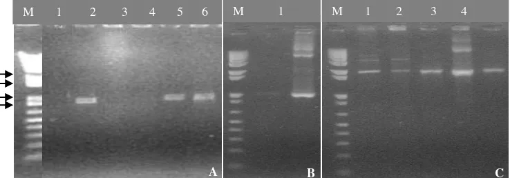 Gambar 3. Profil elektroforesis hasil PCR dari (A) Koloni  E. coli rekombinan yang membawa fragmen P5CS 