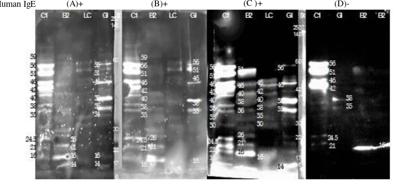 Gambar 1. Analisis Western blot sampel protein lateks menggunakan serum tiga orang tenaga medis yang 