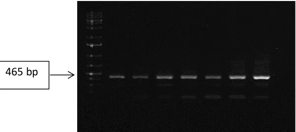 Gambar 3. Elektroforegram RNA total yang diisolasi dari daun tebu pada berbagai perlakuan cekaman kekeringan (T0, T4, T8, T12, T16, T20 dan T25) .Tanda panah menunjukkan subunit rRNA yaitu 25S dan 18S Figure 3