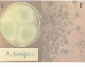 Gambar 1 . Aspergillus fumigatus, penyebab uta- uta-ma aspergillosis. (A), biakan pada medium agar Sabouraud; clan (B), morfologi mikroskopik.