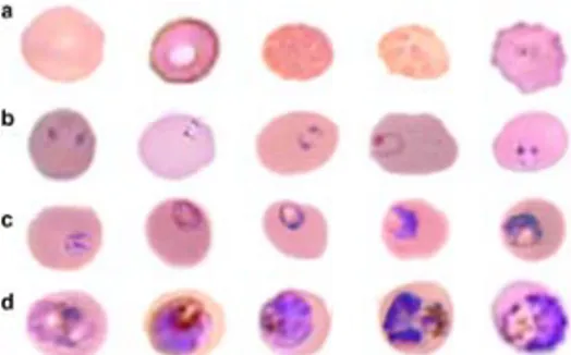 Gambar 9. Citra sel darah merah normal dan terinfeksi parasit (a. Sel darah merah  normal dengan berbagai bentuk dan warna b