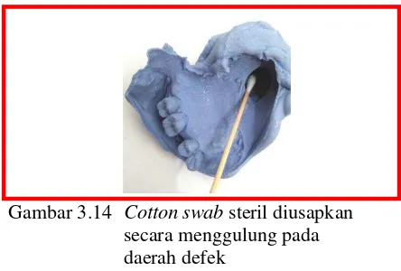Gambar 3.14 Cotton swab steril diusapkan  