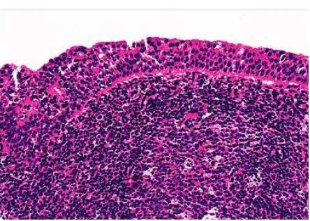 Gambar 2.2. Histologi nasofaring. Epitel pelapis nasofaring terdiri dari epitel transisional dengan stroma yang kaya jaringan limfoid.11 