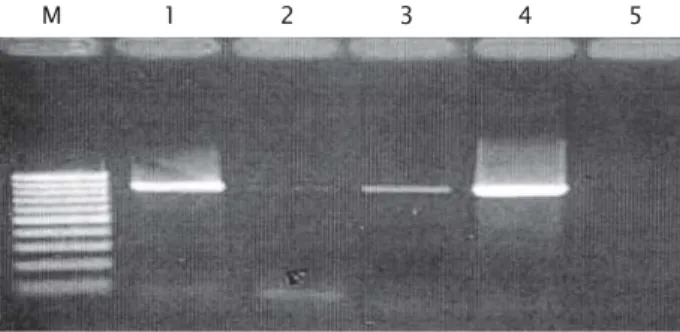 Gambar 2. Hasil ekstraksi DNA S. iniae dengan 3 macam metode. M. Marker; Lane 1. Metode pemanasan; Lane 2