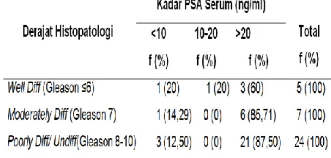 Tabel 4.Distribusi Frekuensi Kadar PSA Se- Se-rum Sebelum Operasi Berdasarkan Derajat  Histopatologi Adenokarsinoma Prostat   