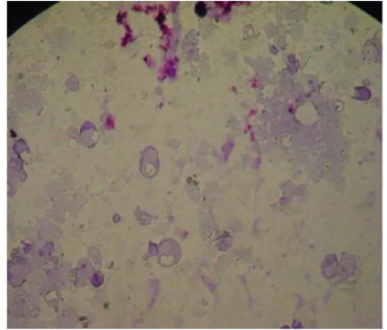Gambar 2.  Hasil uji in vivo infeksi Mtp. 