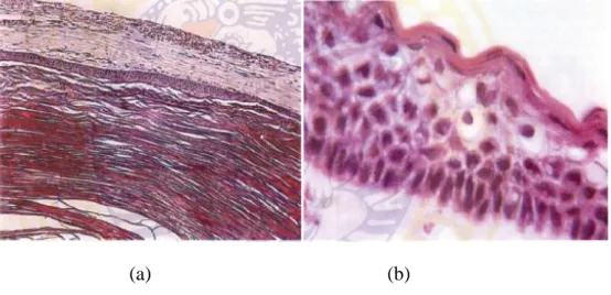 Gambar 2.8 :  Gambaran histopatologis kista keratosis  odontogenik (a) pada lapisan ortokeratin (b) 