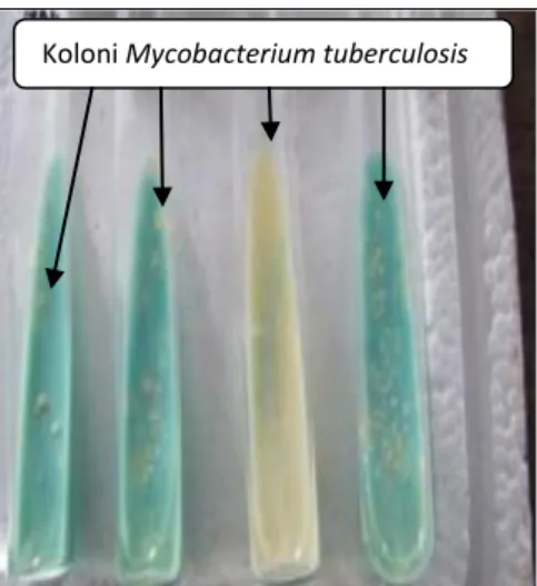 Gambar 2.5  Koloni Mycobacterium tuberculosis yang berwarna putih  kekuningan pada medium Lowenstein-Jensen yang berwarna putih kehijauan  (Amin dan Bahar,  2009).