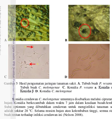 Gambar 5  Hasil pengamatan jaringan tanaman sakit.  A. Tubuh buah P. vexans  B. 