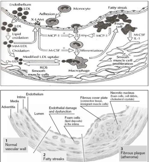 Gambar 2.1 : Proses Aterosklerosis 