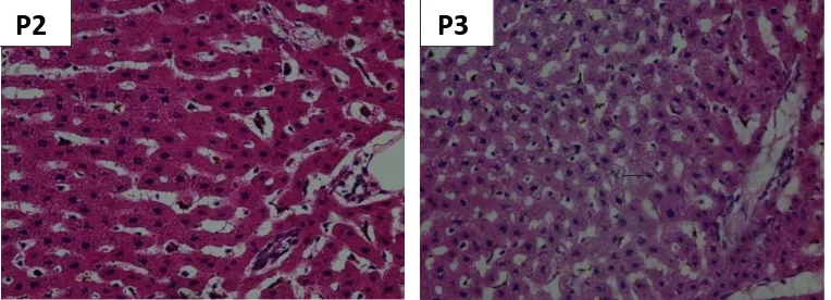 Gambar 1. Gambaran histologi hepar tikus wistar (400x, HE).() : sel 