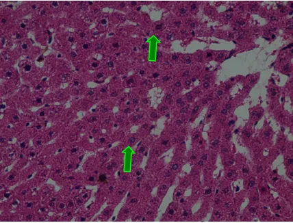Gambar 1. Gambaran histopatologi hepar tikus wistar pada kelompok K dengan 