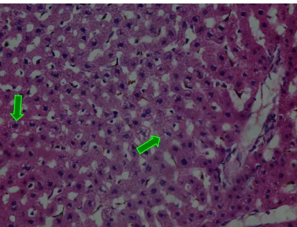Gambar 2. Gambaran histopatologi hepar tikus wistar pada kelompok P1 dengan 