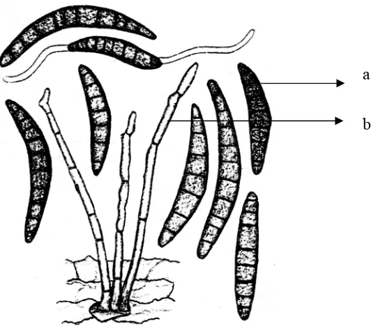Gambar 3.  H.  turcicum Pass., a : konidia, b : konidiofor Sumber : Shurtleff (1980) 