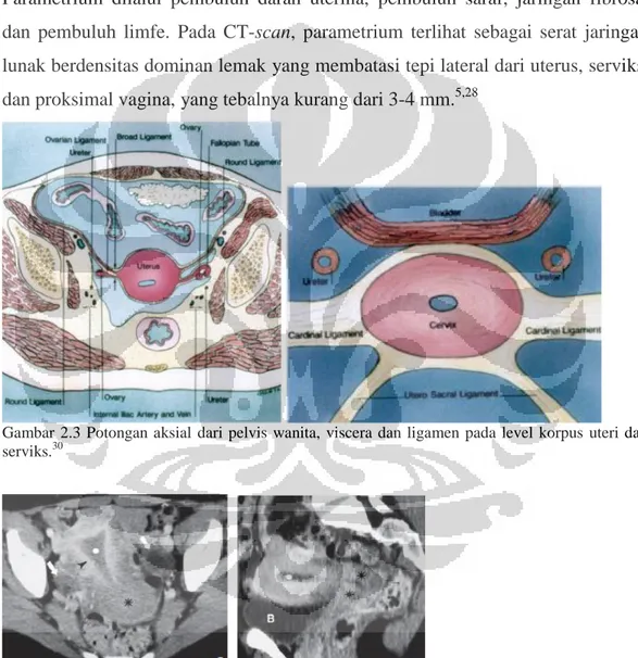 Gambar  2.3  Potongan  aksial  dari  pelvis  wanita,  viscera  dan  ligamen  pada  level  korpus  uteri  dan  serviks