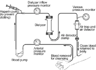 Gambar 2. Skema Proses Hemodialisis  1.2.2  Water treatment 