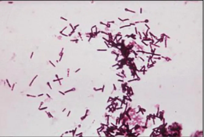 Gambar 1. Pewarnaan Gram C. tetani. Bakteri tersebut bersifat Gram positif tetapi memiliki kecenderungan  variabilitas dalam pewarnaan Gram