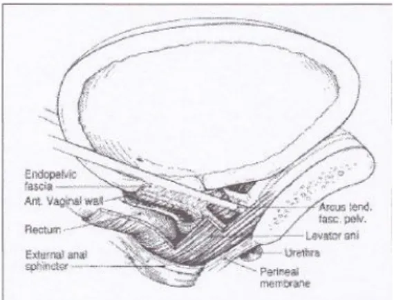 Gambar 2. Pendesakan fasia endopelvis menuju fasia arkus tendineus pelvis dan otot levator ani  (diambil dari kepustakaan 4) 