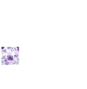 Gambar 2.  Kista Pneumocystic jirovecii dengan pewarnaan Giemsa Dikutip dari (14)