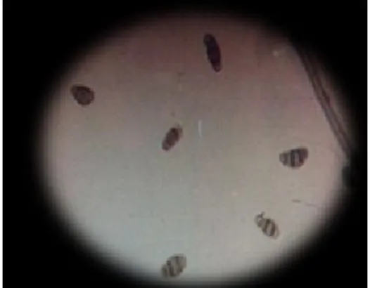 Gambar 4. Konidia Pyricularia oryzae (perbesaran 10x40)