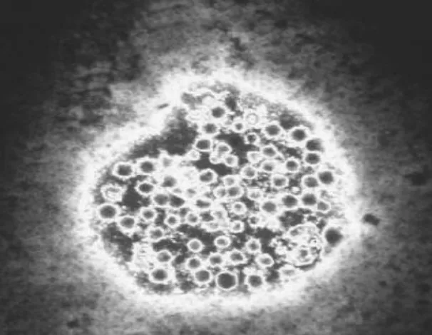 Gambar virus hepatitis A