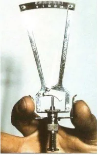 Gambar 2.3. Applanasi tonometer.17
