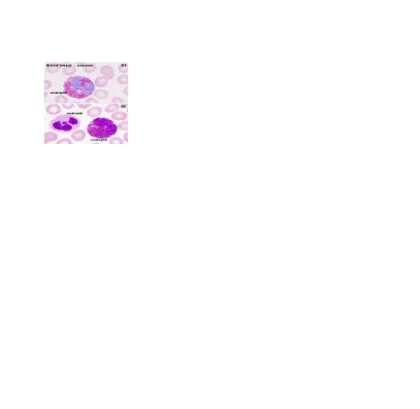 Gambar 2 eosinofil
