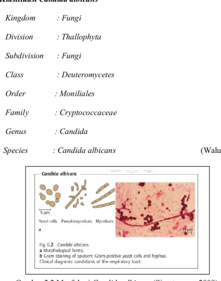 Gambar 2.2 Morfologi Candida albicans (Simatupang, 2009)  Keterangan: 