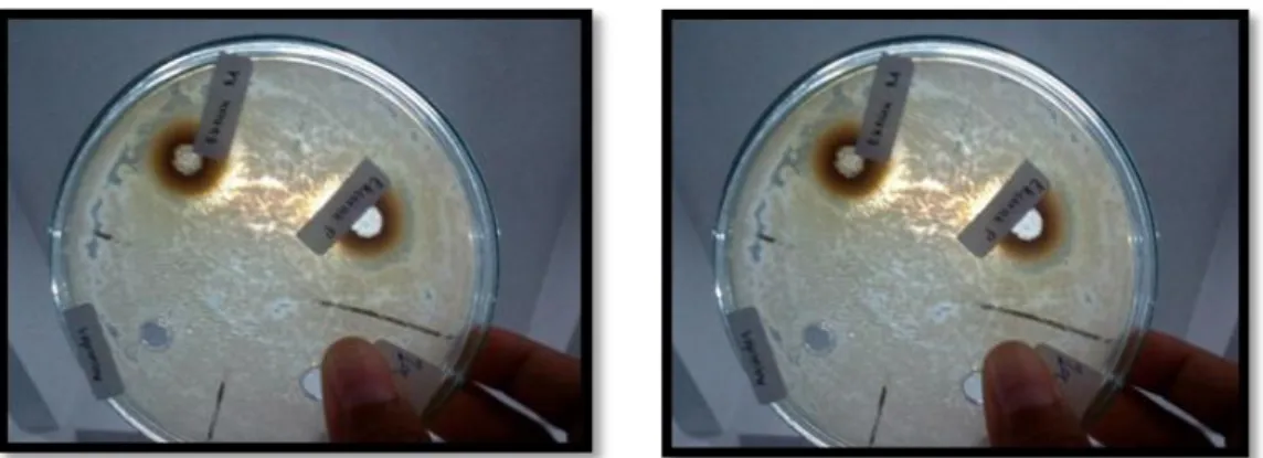 Gambar 1. Zona Bening hasil uji daya hambat pertumbuhan bakteri Lactobacillus  acidophilus 