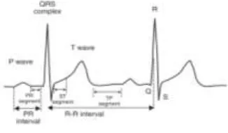 Gambar 11. Hasil Pentapisan baseline 