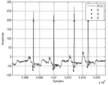 Gambar 13. kompleks, gelombang P dan T pada sinyal Hasil Deteksi QRS 100.dat 